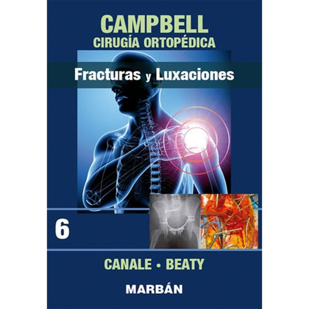 Cirugía Ortopédica - Fracturas y Luxaciones. Tomo 6