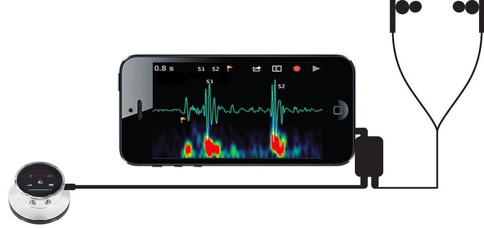 
                  
                    ThinkLabs ONE Digital Stethoscope
                  
                