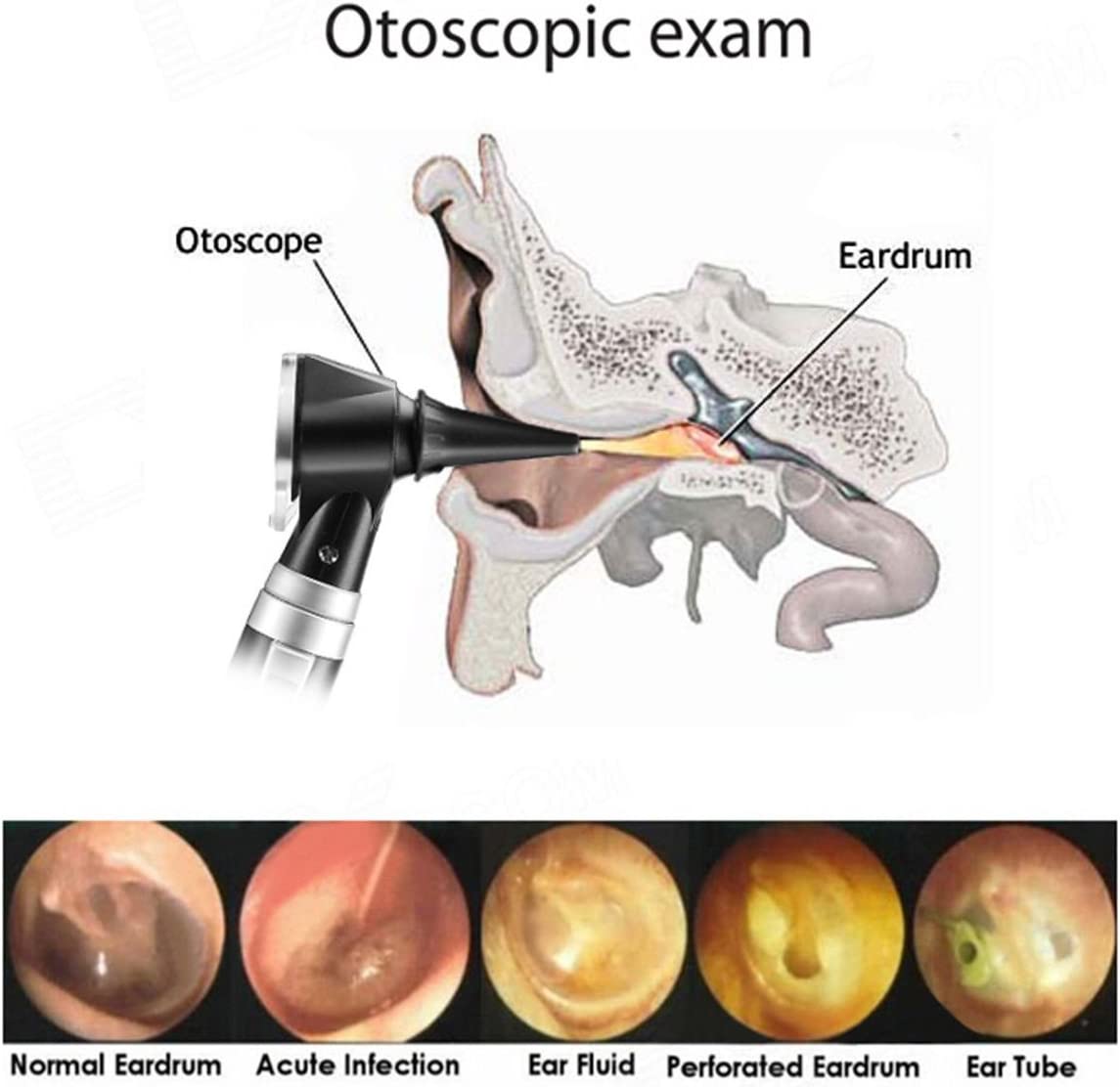 
                  
                    ENT Diagnostic Set: Rechargeable LED Fiber Optic Otoscope and Ophthalmoscope
                  
                