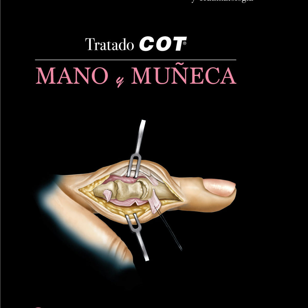 Tratado COT - 3.3 Mano y Muñeca. COT Grupo Científico